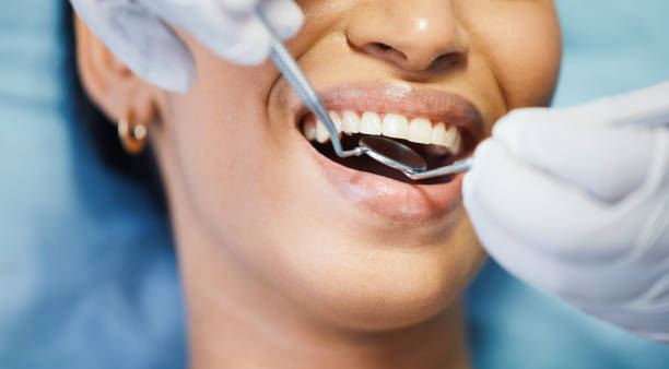 Best Emergency Dental Care for Sports Injuries in Ller, WA