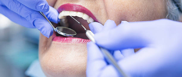 Best Emergency Treatment for Oral Infections in Ller, WA
